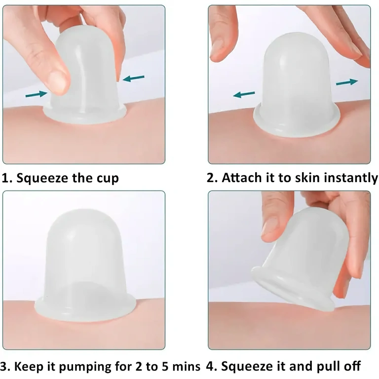Set of 4 vacuum therapy cups for anti-cellulite massage