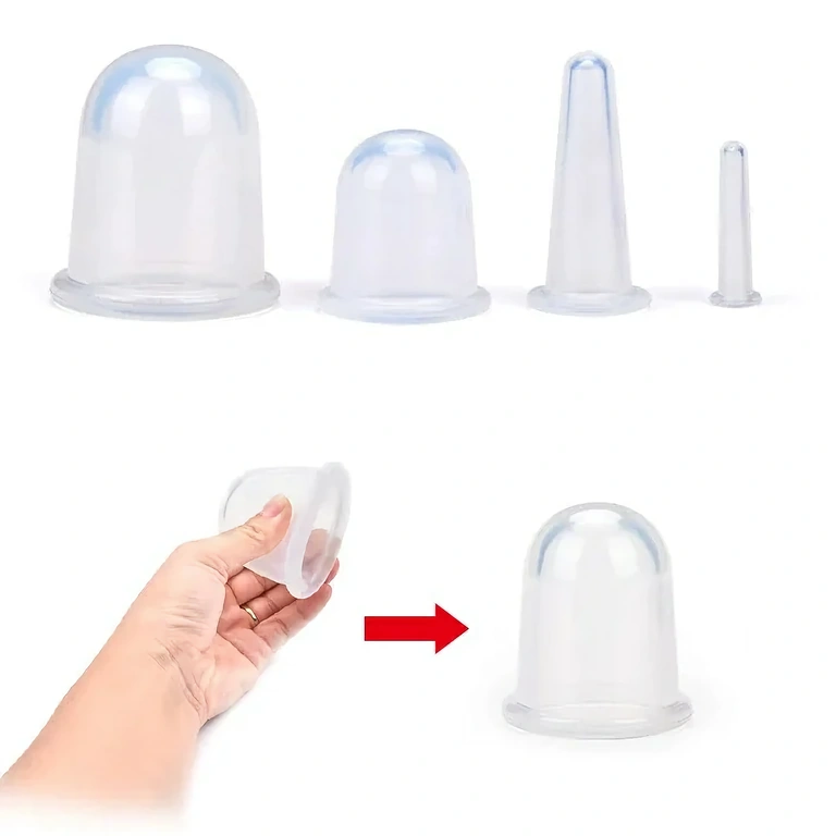 Cupping therapy for fat and cellulite reduction